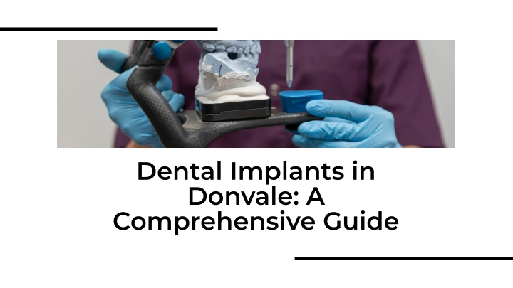 dental implants in donvale a comprehensive guide