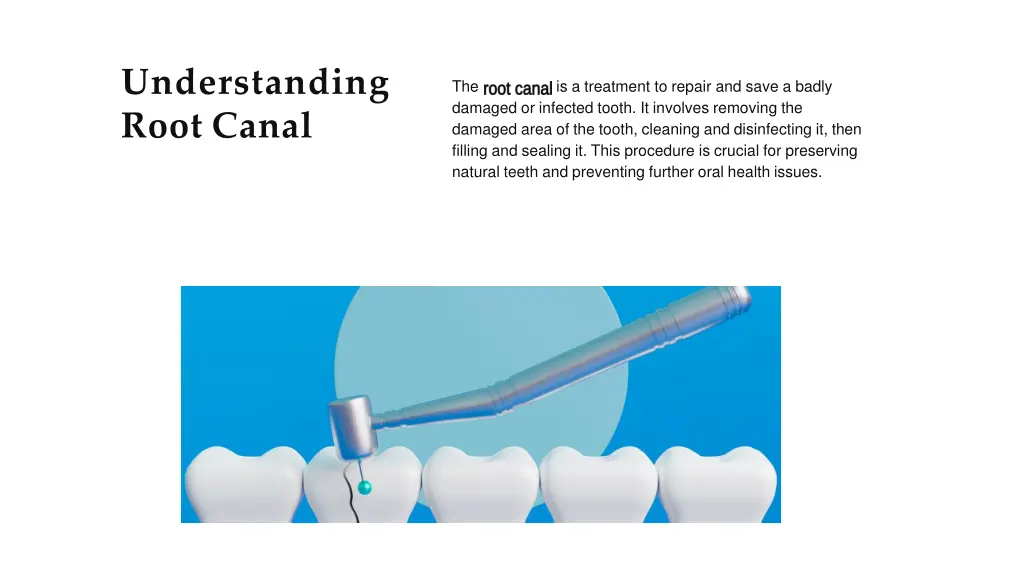 understanding root canal