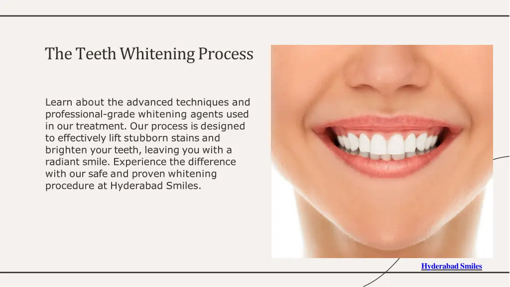 the teeth whitening process