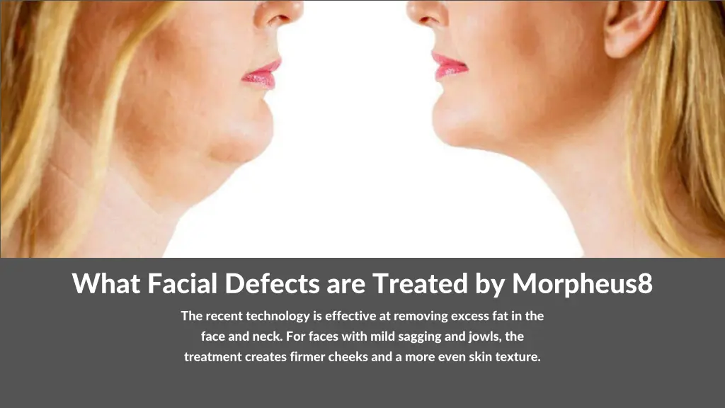 what facial defects are treated by morpheus8