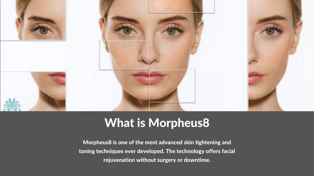 what is morpheus8