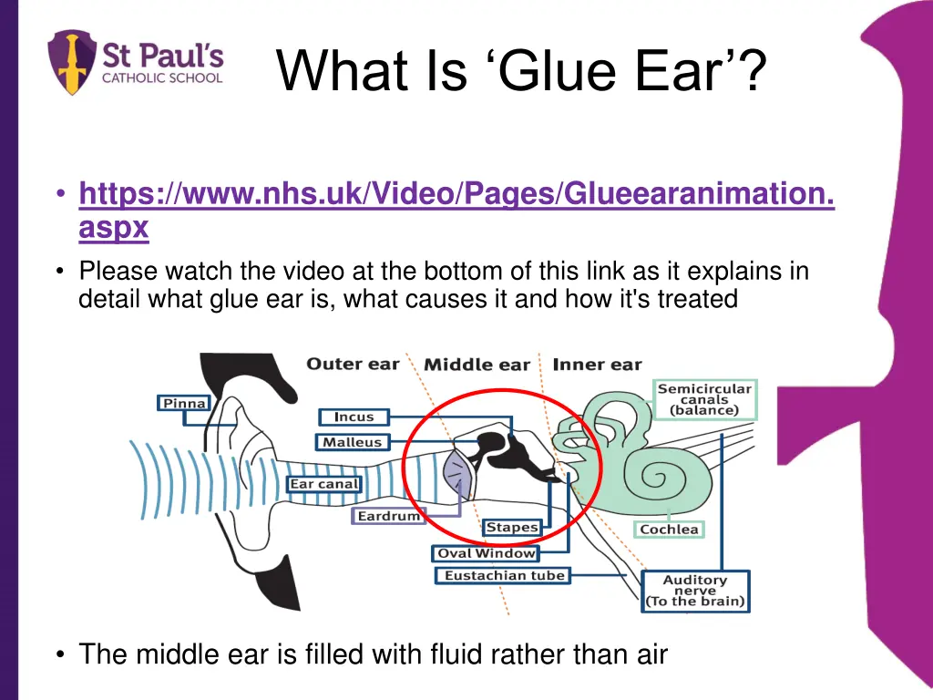 what is glue ear 1