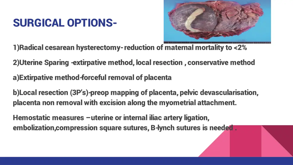 surgical options