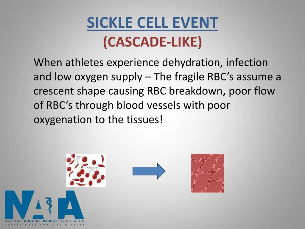 sickle cell event cascade like