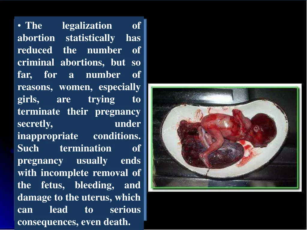 the abortion reduced criminal abortions