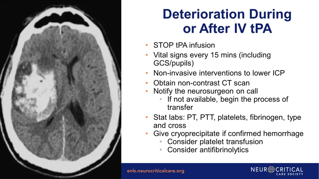 deterioration during or after iv tpa