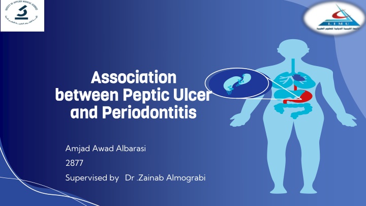 association association between peptic ulcer