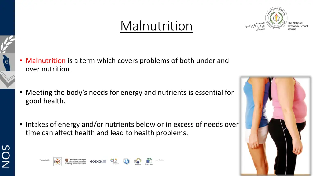 malnutrition