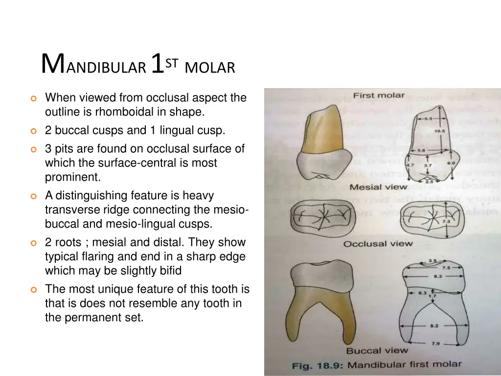 m andibular 1 st molar