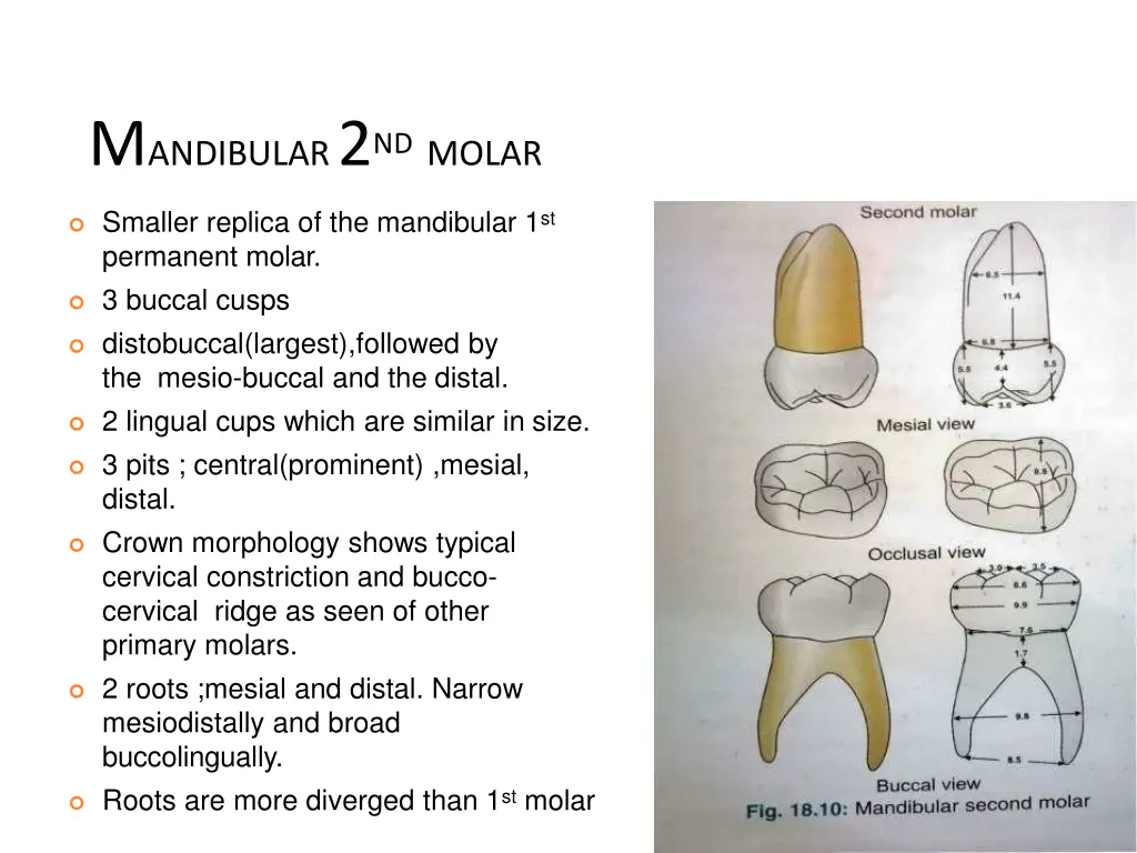 m andibular 2 nd molar