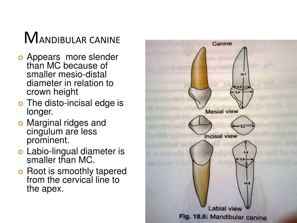 m andibular canine