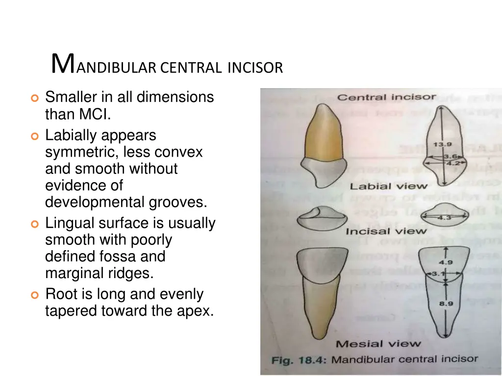 m andibular central incisor