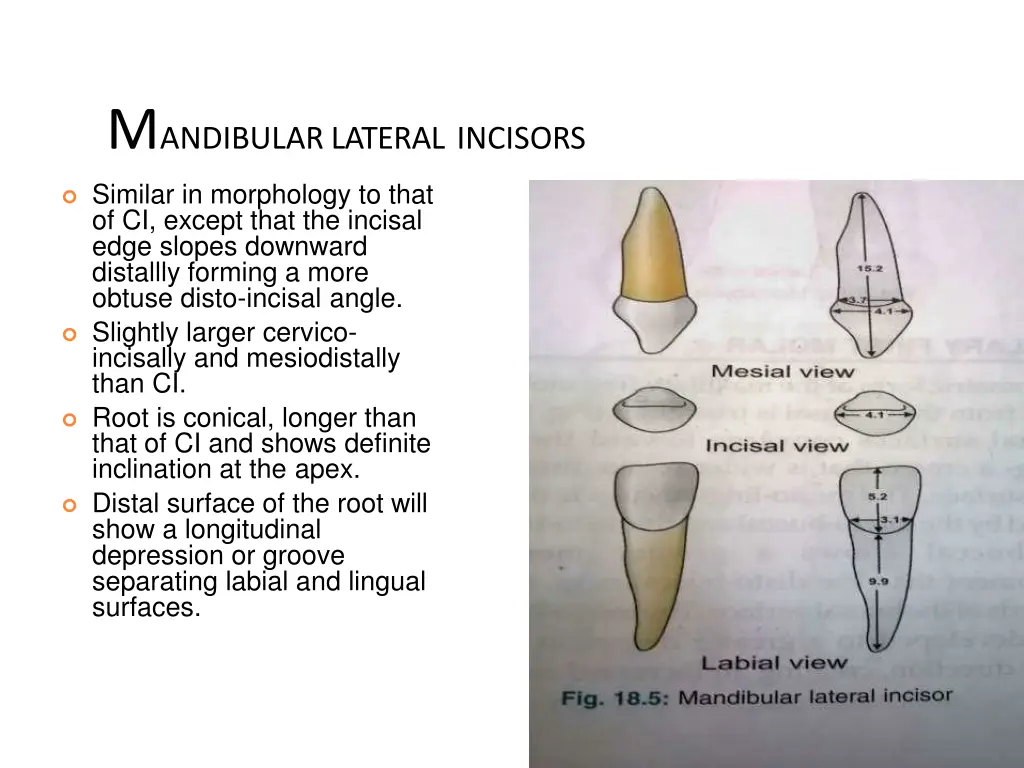 m andibular lateral incisors