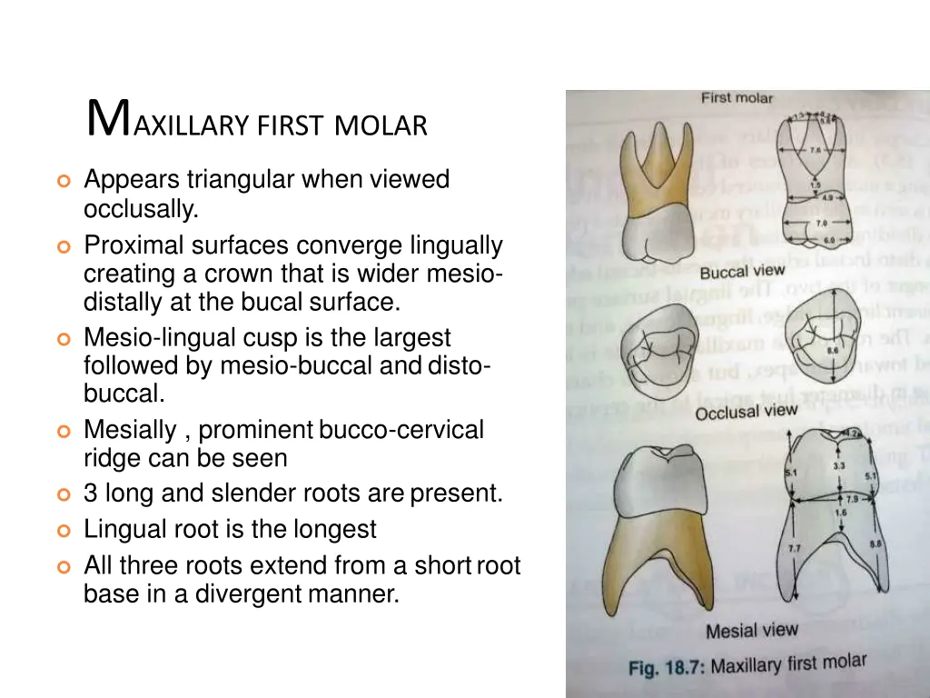 m axillary first molar