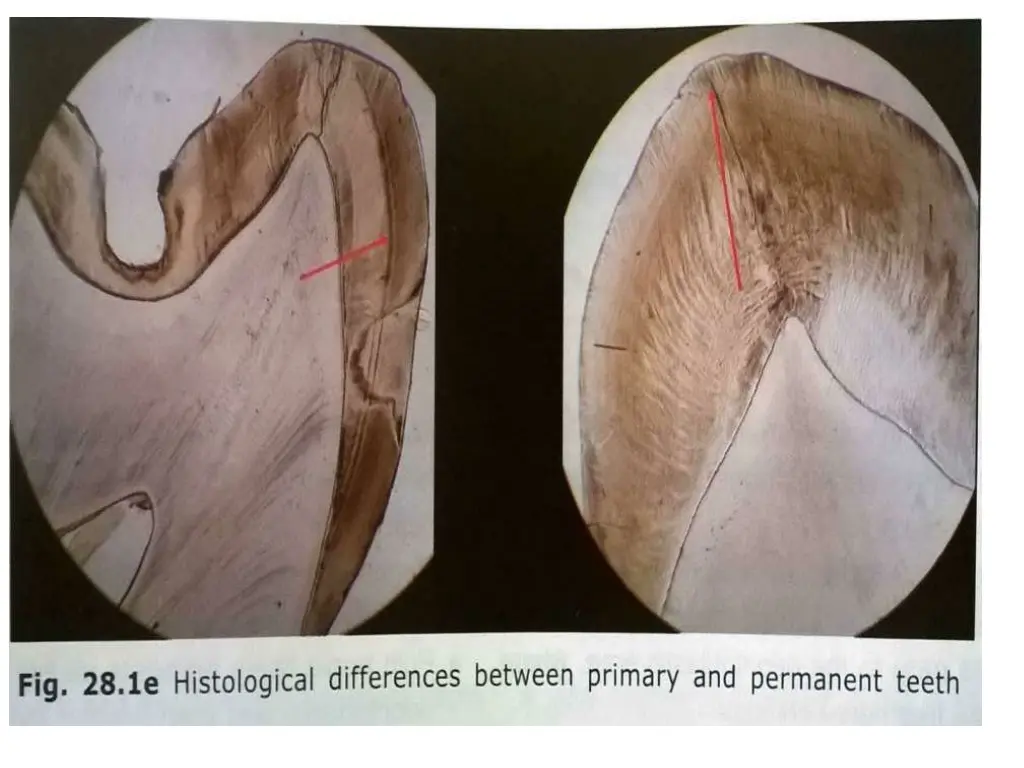 slide24