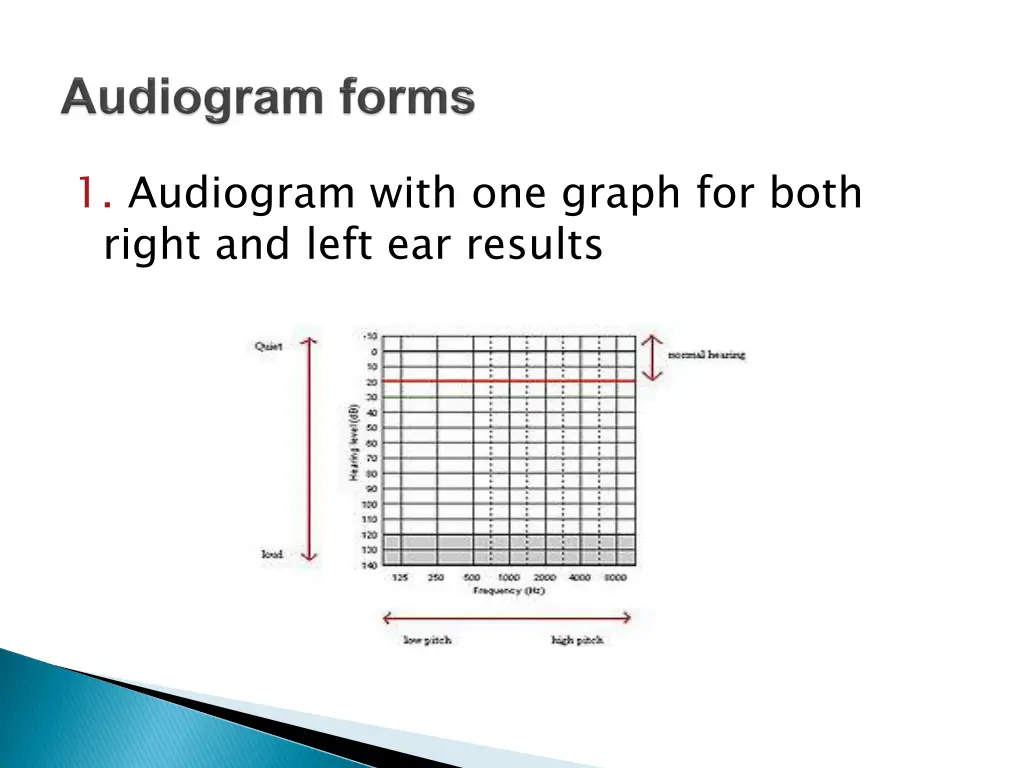 1 audiogram with one graph for both right