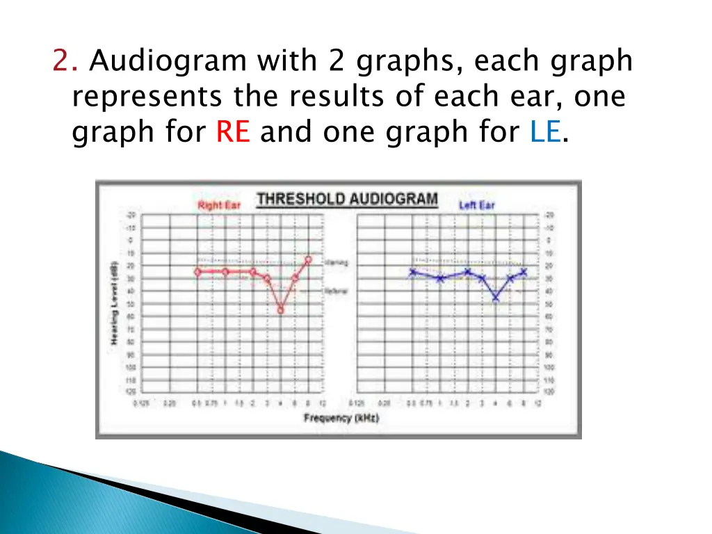 2 audiogram with 2 graphs each graph represents