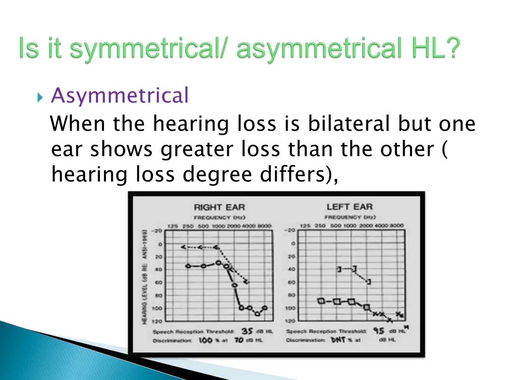 asymmetrical when the hearing loss is bilateral