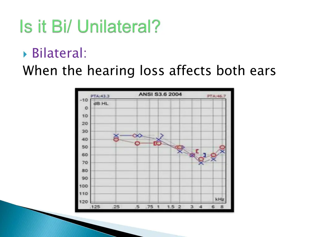 bilateral when the hearing loss affects both ears