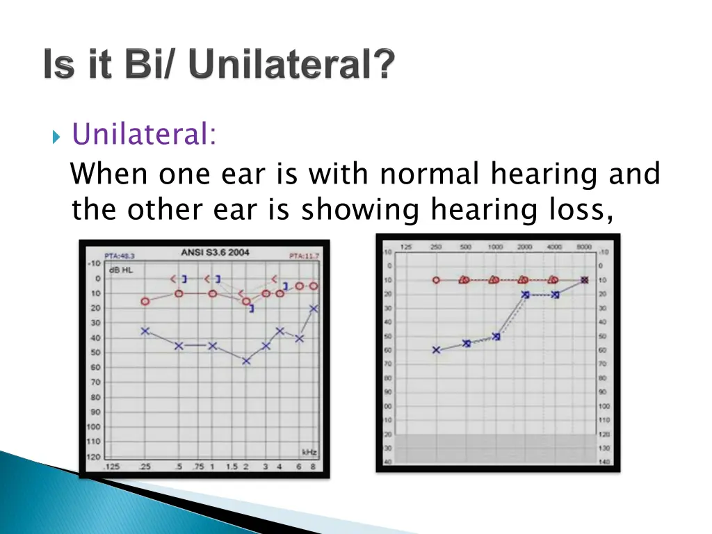 unilateral when one ear is with normal hearing