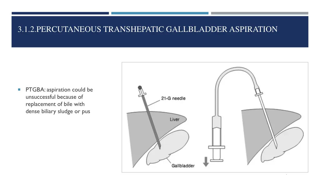 3 1 2 percutaneous transhepatic gallbladder