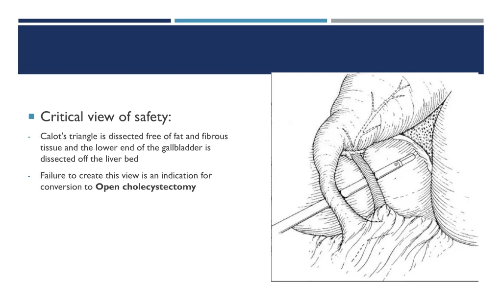 critical view of safety