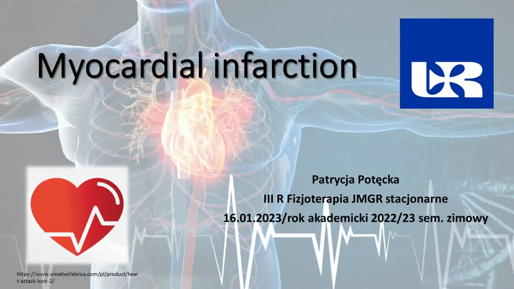 myocardial myocardial infarction