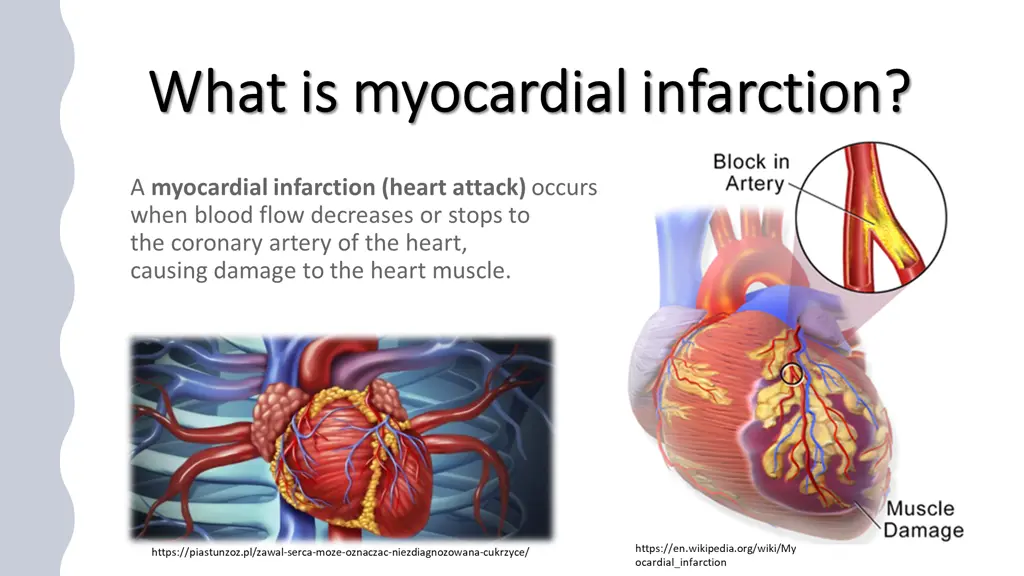 what what is is myocardial myocardial infarction