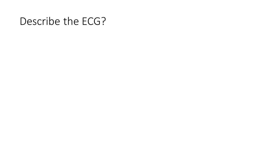 describe the ecg