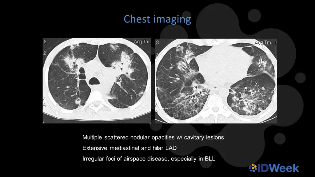 chest imaging