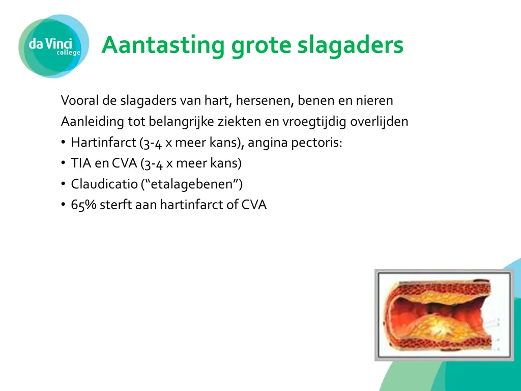 aantasting grote slagaders