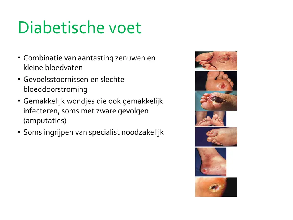 diabetische voet