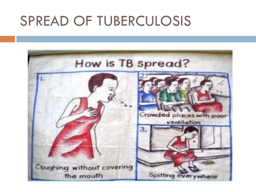 spread of tuberculosis