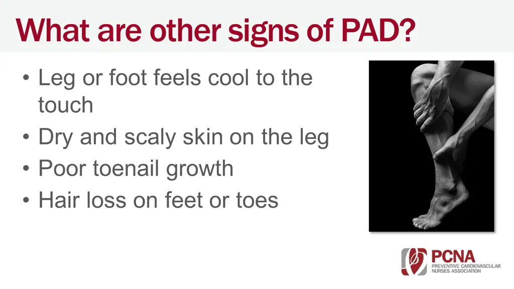 what are other signs of pad