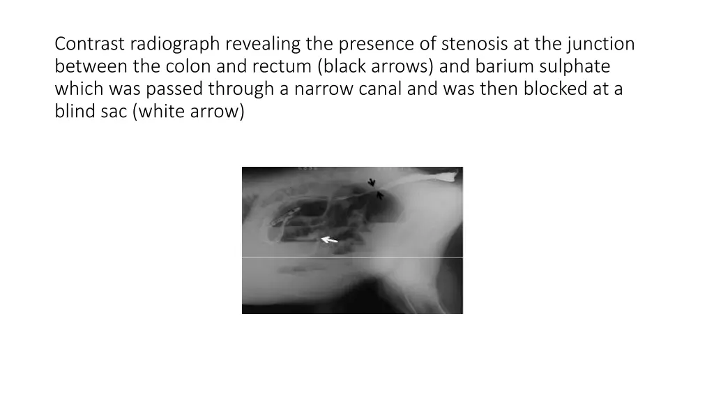 contrast radiograph revealing the presence