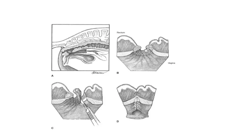 slide29