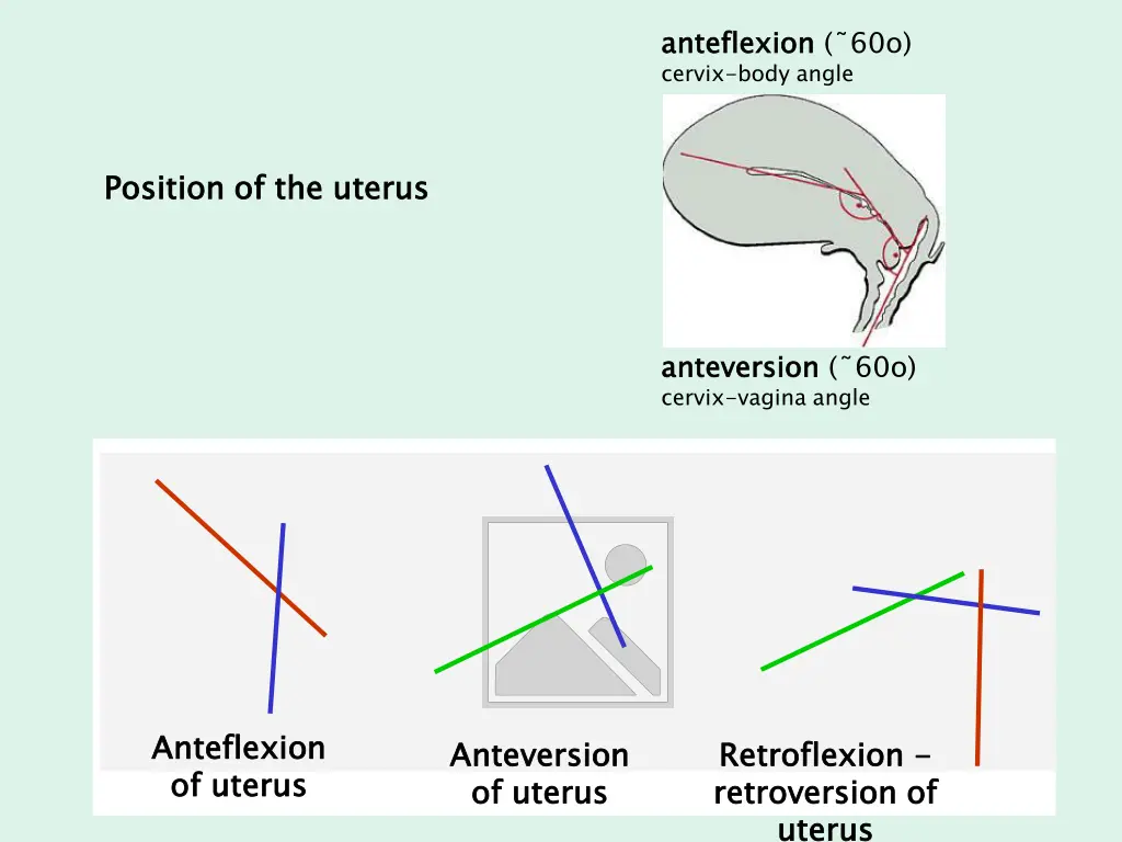 anteflexion cervix body angle