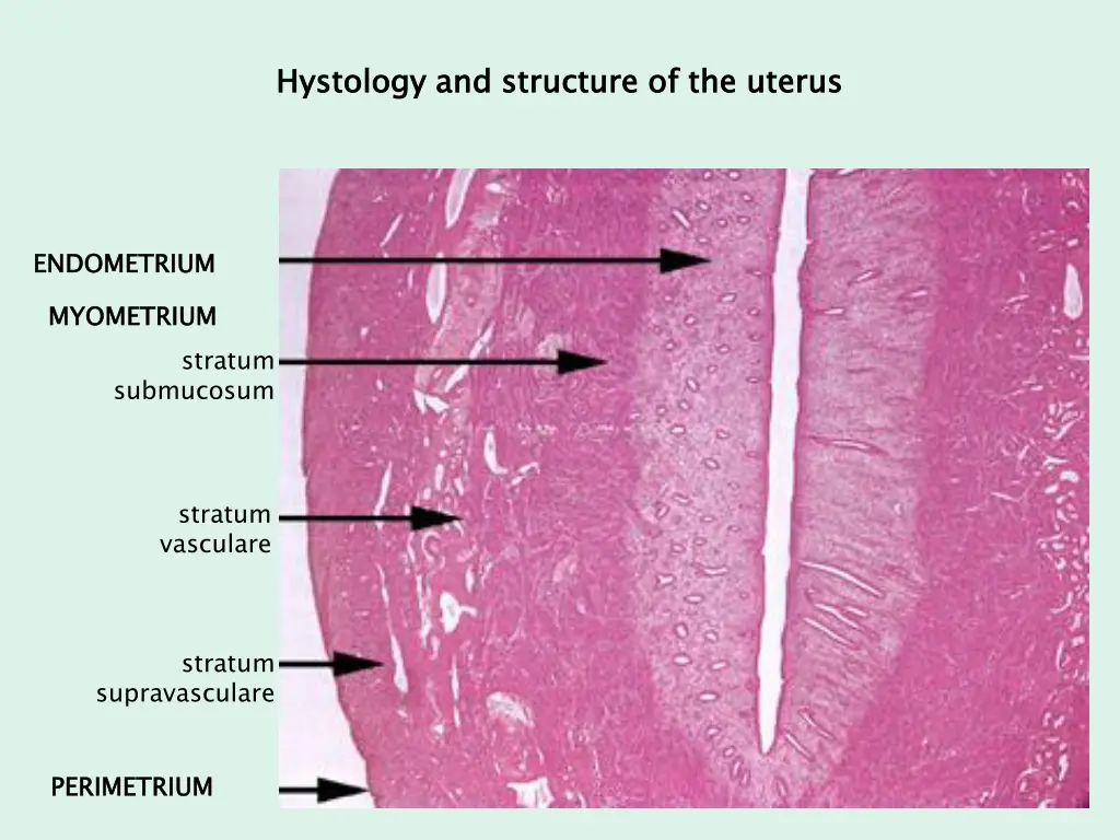 hystology and structure of the uterus