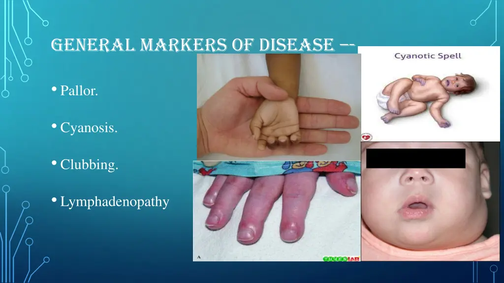 general markers of disease