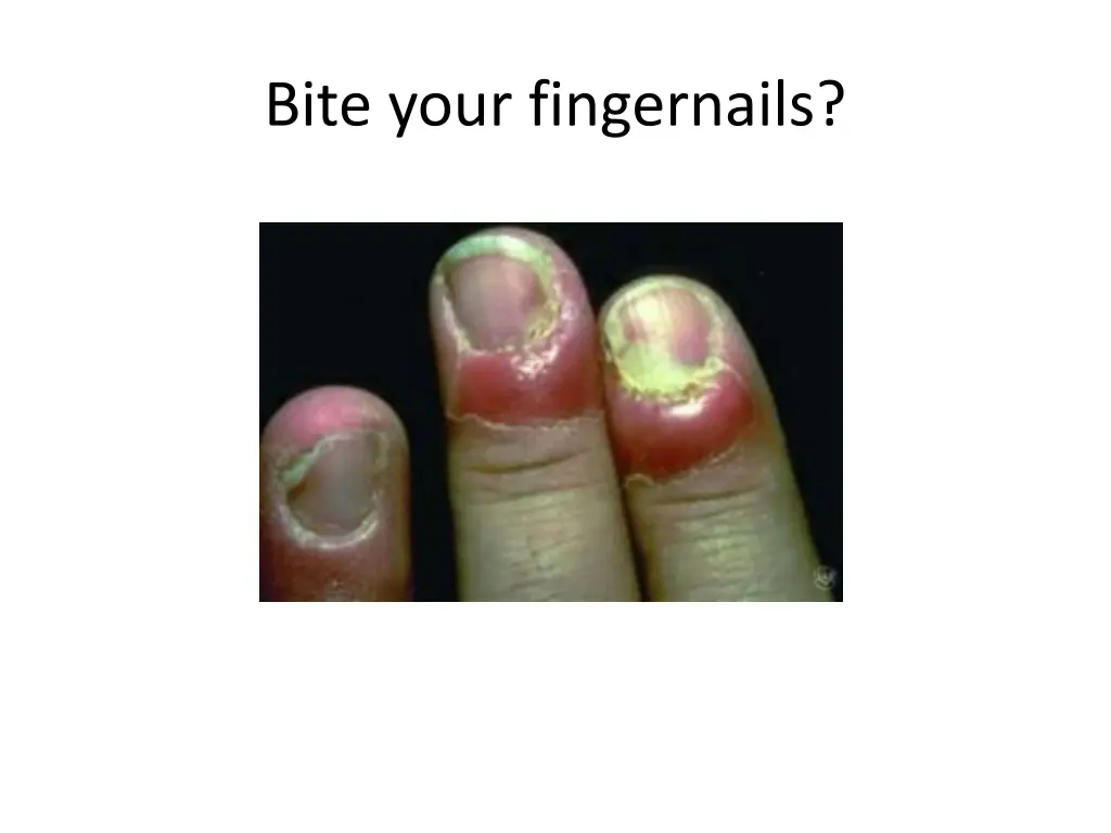 bite your fingernails