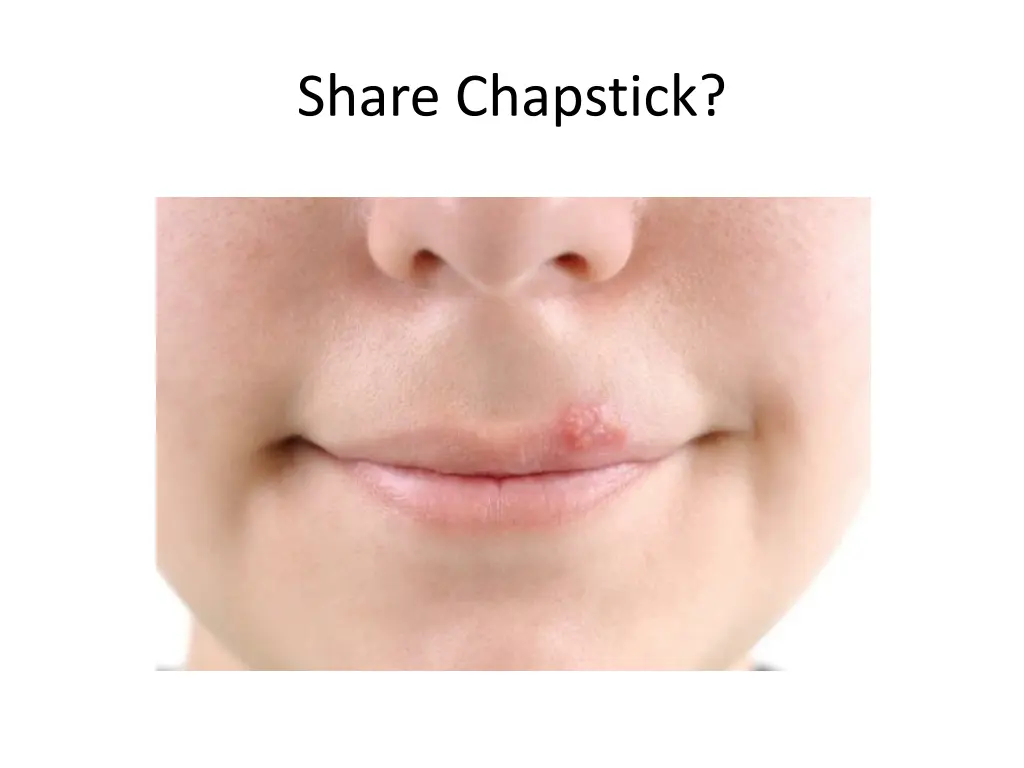 share chapstick