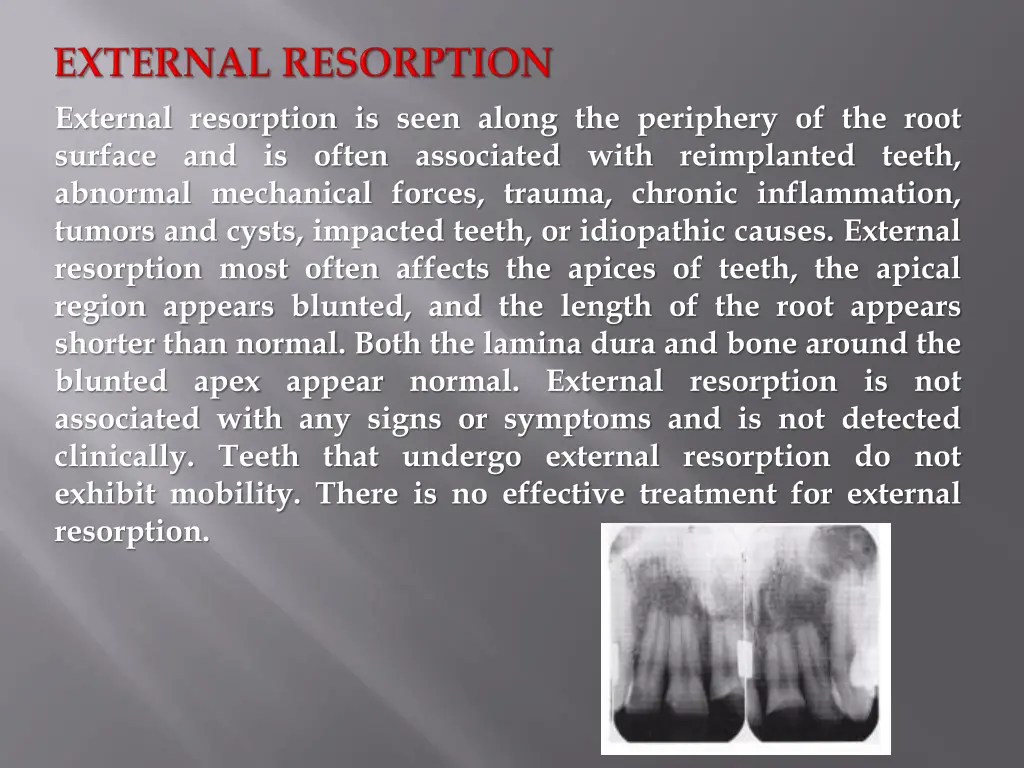 external resorption is seen along the periphery