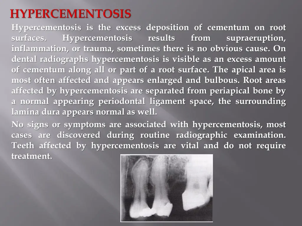 hypercementosis is the excess deposition