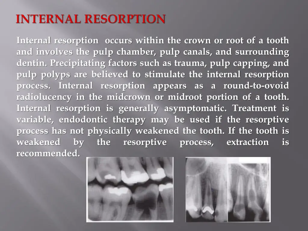 internal resorption occurs within the crown