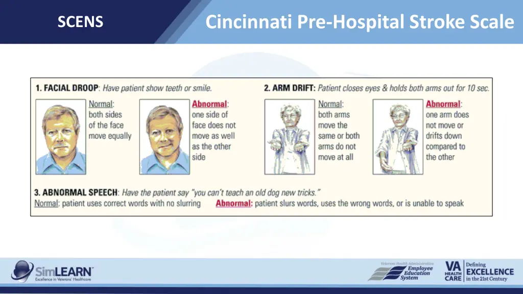 cincinnati pre hospital stroke scale