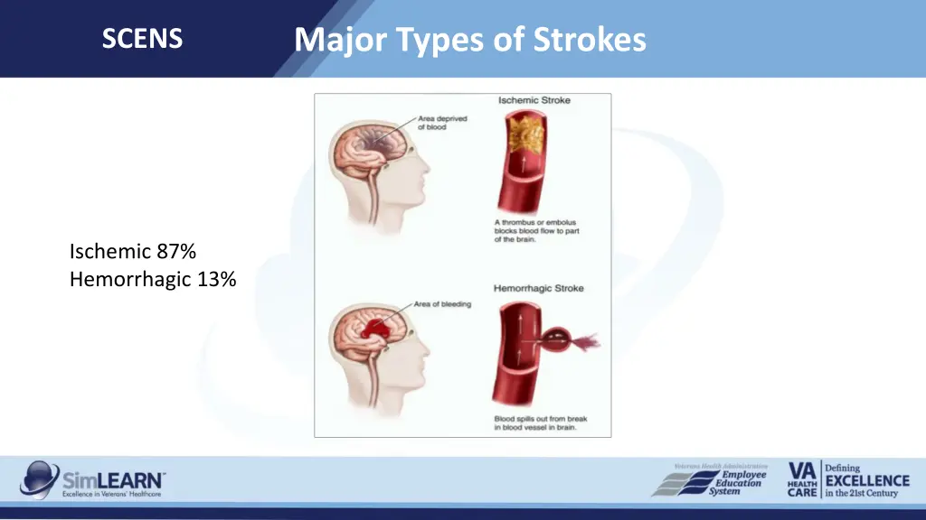 major types of strokes