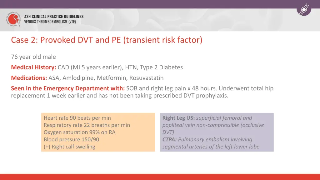 case 2 provoked dvt and pe transient risk factor