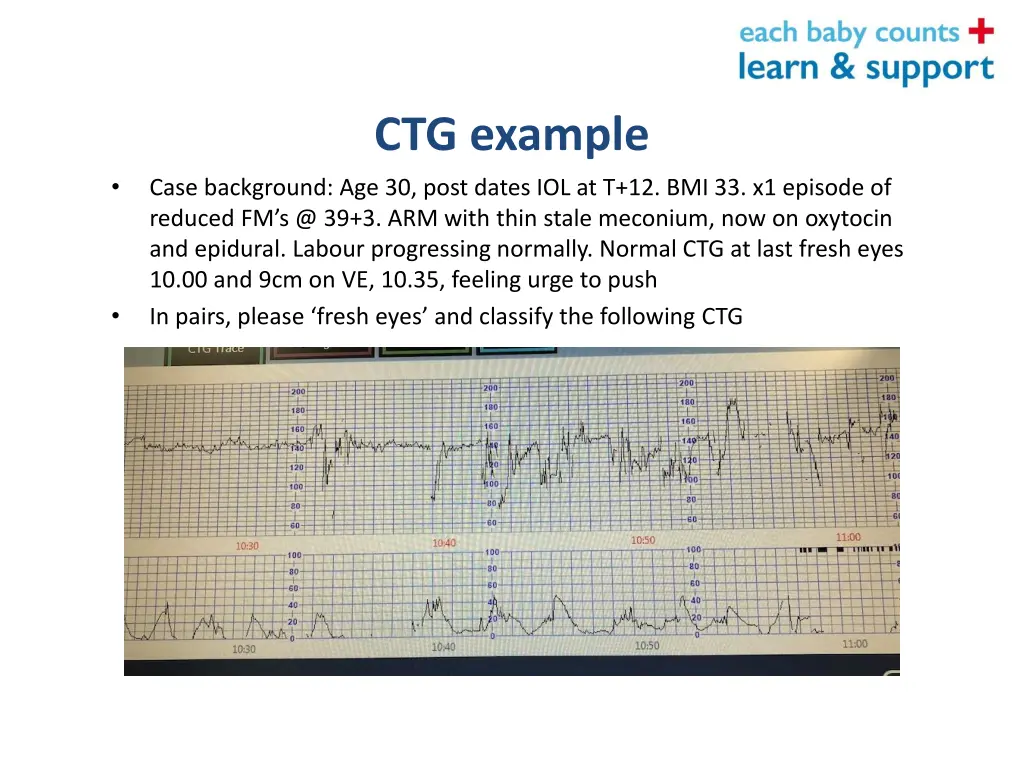 ctg example