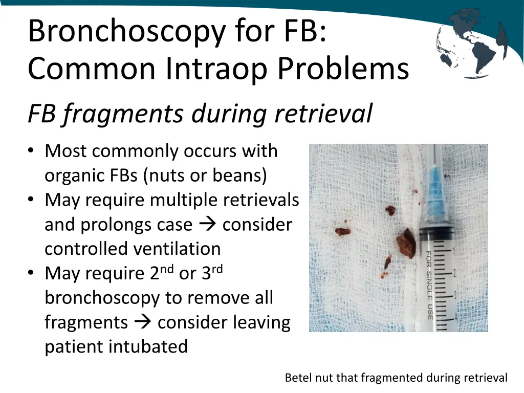 bronchoscopy for fb common intraop problems 2