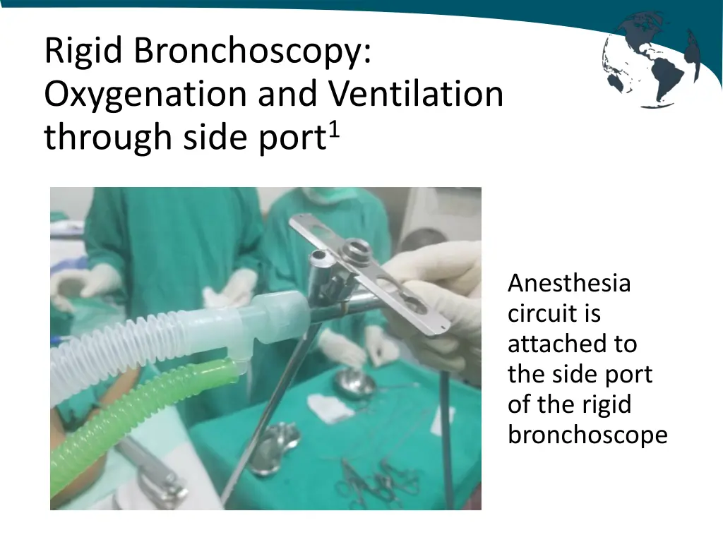 rigid bronchoscopy oxygenation and ventilation